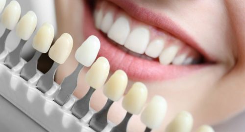 Will whitening products damage crowns